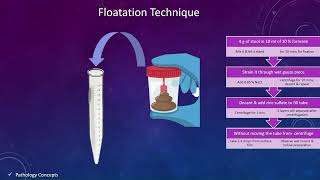 Concentration techniques in Stool  Floatation techniques  Sedimentation techniques  parasites [upl. by Akila]