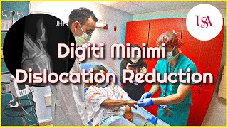 Digiti Minimi Dislocation Emergency [upl. by Reppiks]