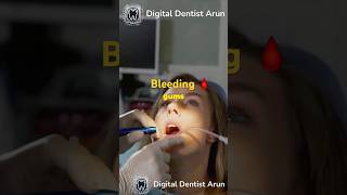 How Dentists Diagnose Periodontitis Key Steps for Identifying Gum Disease [upl. by Benedicto]