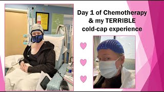 Day 1 of AC chemotherapy amp my TERRIBLE cold cap experience [upl. by Herta]