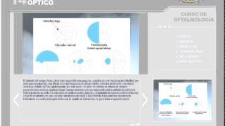 CURSO CTO OFTALMOLOGÍA PARTE 2 [upl. by Rehtnug]