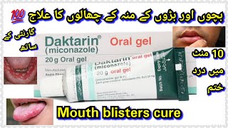 Daktarin oral gel how to usefor mouth fungel infectionDaktarin oral gel for babiesreview [upl. by Oleg]