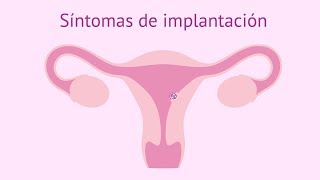 Síntomas de implantación del embrión [upl. by Lurleen]