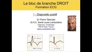 4e Bloc de branche droit 1 Diagnostic positif ECG Dr Taboulet [upl. by Bolitho957]