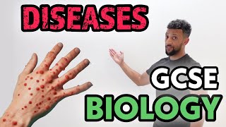 GCSE Biology  Infectious Diseases Rap [upl. by Mairym]