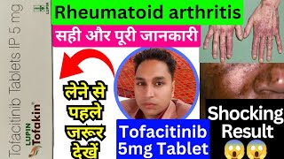 tofacitinib 5 mg tablet hindi  tofacitinib tablets 5mg  tofatas tablet 5 mg  tofakin tablet [upl. by Chubb]