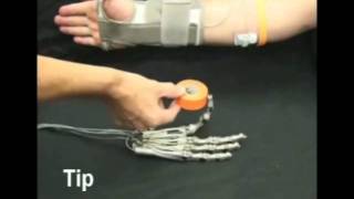 Vanderbilt MultiGrasp Hand Prosthesis [upl. by Chambers]