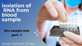 How to isolate RNA from blood plasma sample  HCV test  part  1  RNA extraction [upl. by Dublin]