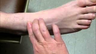 Sample Video  Palpate for Dorsalis Pedis Pulse [upl. by Corrie852]