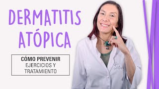 Dermatitis Atópica  Cómo Curar la Piel Atópica [upl. by Illom]