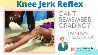 knee jerk reflex I all 4 grades with demo on patients I brisk tendon reflex rootvalue I neurology [upl. by Gelman971]