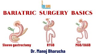 Longterm nutritional consequences of bariatric surgery [upl. by Zahavi120]