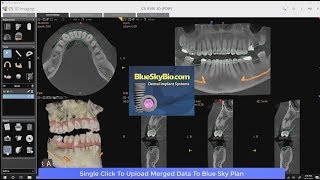 CS 3D Imaging Blue Sky Integration [upl. by Ruyam311]