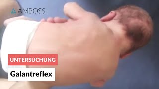 Galantreflex  Frühkindliche Reflexe  AMBOSS Video [upl. by Enileuqcaj]