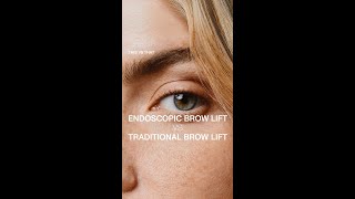 Brow Lift Surgery  Endoscopic vs Traditional Brow Lift with Dr Guy Massry [upl. by Wind]