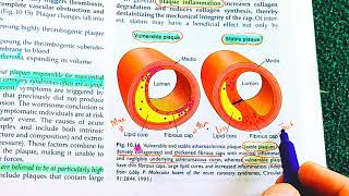 Atherosclerosis Robbins Pathology Atherosclerosis vs Arteriosclerosis  Atherosclerosis Pathology [upl. by Amocat]