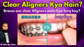 Clear Aligners Invisible Aligners procedure Braces vs clear aligners Invisalign [upl. by Devinne]