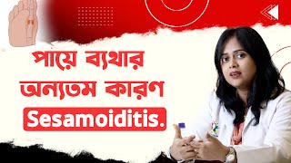 পায়ে ব্যথার অন্যতম কারণ Sesamoiditis [upl. by Asilav]