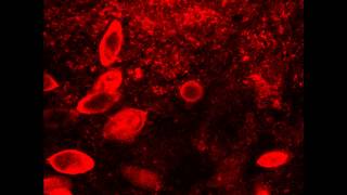 Parasitic Schistosoma haematobium eggs visualized in the bladder by 2photon microscopy [upl. by Tamara]