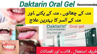 How to use Daktarin oral gel  uses in Urdu [upl. by Waddington229]