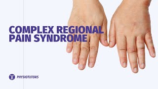 Complex Regional Pain Syndrome  CRPS  Wrist amp Hand [upl. by Nerin220]