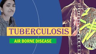 TUBERCULOSIS II MEDICAL MICROBIOLOGY II AIRBORNE DISEASE [upl. by Tnomel]