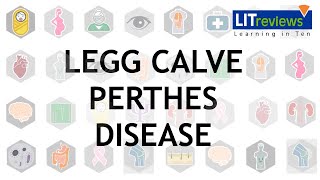 Legg Calve Perthes Disease [upl. by Gualterio331]