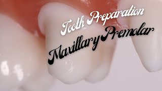 Tooth Preparation for PFM 🔵 Maxillary First Premolar 🟡 Step by Step Demonstration [upl. by Cutlip]