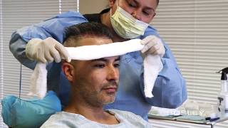 Bosley FUE Procedure Edgars Journey Hair Transplant  How Its Done [upl. by Chow]