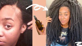 😲RESULTS IN 2 DAYS USE THIS HEALTHIEST SCALP MASSIVE HAIR GROWTH amp REGROWTH🤯 [upl. by Alyled]