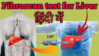 What is Fibroscan Test for Liver Explained in Hindi  Use Price and Normal Range [upl. by Tremain]