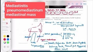 Mediastinitis  pneumomediastinum  mediastinal mass Respiratory 64  First Aid USMLE Step 1 [upl. by Negam346]