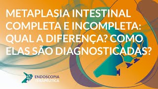 Metaplasia intestinal completa e incompleta qual a diferença Como elas são diagnosticadas [upl. by Hausmann]