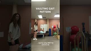 VAULTING GAIT PATTERN [upl. by Aynodal756]