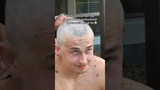 Dry Skin big Dandruff scalp get ride 😱😭 ridofdandruffdandruffremovalnaturally [upl. by Enaoj]