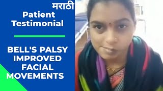 Bells Palsy Patient Recovery Feedback Post Physiotherapy Treatment  leadphysiocom [upl. by Clintock]