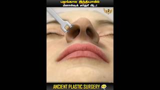 INDIA USE PLASTIC SURGERY IN ANCIENT PERIOD 😱  RHINOPLASTY SURGERY  MIC LA SOLLU  IN TAMIL [upl. by Nestor]