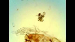 Coleps and paramecium [upl. by Eimak950]