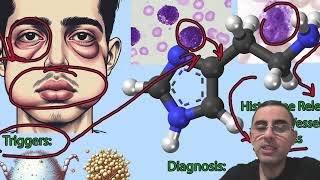 Understanding Hives Urticaria Symptoms Causes and Treatments [upl. by Desberg]