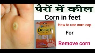 Corn removal under feet Hindicorn caps use karne ka tarika hindi Review [upl. by Nowyt]