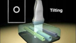 Ultrasound Transducer Manipulation [upl. by Farny]