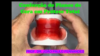 9  Plano de cera para Prótese Total [upl. by Ahtamas91]