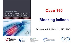 Case 160 Manual of PCI  Blocking balloon [upl. by Blythe485]