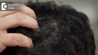 What are the causes of a sensitive and painful scalp  Dr Amee Daxini [upl. by Constantine]