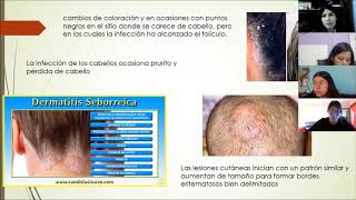 Micosis cutaneas y dermatofitas [upl. by Yrahcaz]