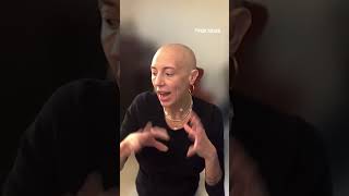 Woman living with alopecia reacts to 4B movement [upl. by Parry413]