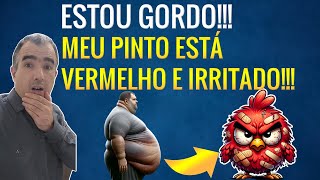 Como a obesidade piora a balanopostite Irritação no Pênis [upl. by Eiramoj250]