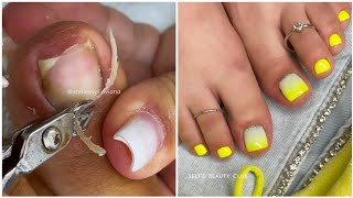 Most Satisfying Pedicure Transformation 😱 best nail polish for toes 2024 [upl. by Anaik]