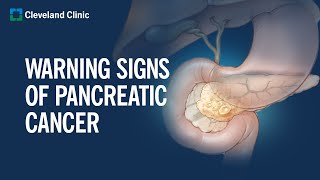 6 Warning Signs of Pancreatic Cancer [upl. by Elleirua]