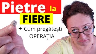 Cum STII daca ai PIETRE la FIERE Operatia de LITIAZA BILIARA [upl. by Gombosi]